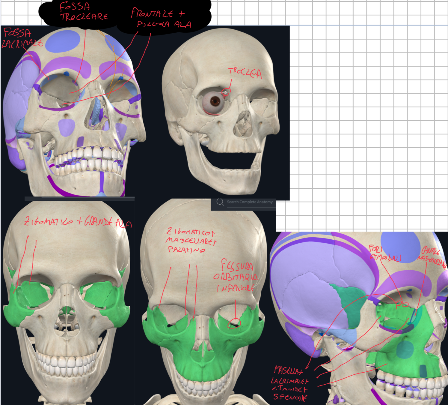 <p>Pareti (partecipano 7 ossa):</p><ul><li><p>Parete Superiore (tetto):</p><ul><li><p>2/3 anteriori formati dalla faccia orbitaria dell’Osso Frontale</p></li><li><p>1/3 posteriore è formato dalla piccola ala dello Sfenoide</p></li><li><p>Questa parete si separa dalla fossa cranica anteriore, dove risiede il lobo frontale</p></li><li><p>Lateralmente sull’osso frontale troviamo la Fossa Lacrimale sede della ghiandola lacrimale, mentre Medialmente abbiamo la Fossa Trocleare per la troclea del muscolo obliquo superiore (importante per i movimenti del bulbo</p></li></ul></li></ul><ul><li><p>Parete Laterale:</p><ul><li><p>1/3 anteriore formato dall’Osso Zigomatico</p></li><li><p>2/3 posteriori dalla grande ala dello Sfenoide</p></li><li><p>Questa parete si separa dalla fossa temporale lateralmente e dalla fossa cranica media superiormente</p></li></ul></li></ul><ul><li><p>Parete Inferiore (pavimento):</p><ul><li><p>Formato da Zigomatico e Mascellare principalmente + la piccola superficie orbitaria del Palatino</p></li><li><p>Questa parete si separa inferiormente dal seno mascellare</p></li><li><p>Il pavimento è separato dalla Fessura Orbitaria Inferiore (tra grande ala dello sfenoide, mascellare, palatino e zigomatico)</p></li><li><p>Fratture in questa zona compromettono i movimenti del bulbo oculare (incarceramento muscolo retto inferiore)</p></li></ul></li><li><p>Parete Mediale:</p><ul><li><p>Formata da:  Mascella  + Osso Lacrimale + Etmoide (lamina papiracea) + Sfenoide (vicino al foro ottico)</p></li><li><p>E’ presente la Fossa del Sacco Lacrimale che conduce al Canale Nasolacrimale e sbocca nel Meato Nasale Inferiore</p></li><li><p>Ci sono poi Fori Etmoidali anteriori e posteriori per vasi e nervi omonimi</p></li><li><p>Questa parete si separa dai seni etmoidali.</p></li></ul></li></ul><p></p>