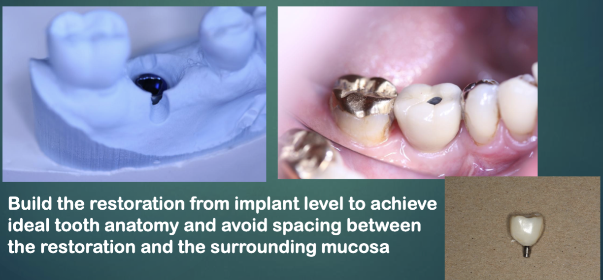 <p>avoid spacing between the restoration and the surrounding mucosa </p>