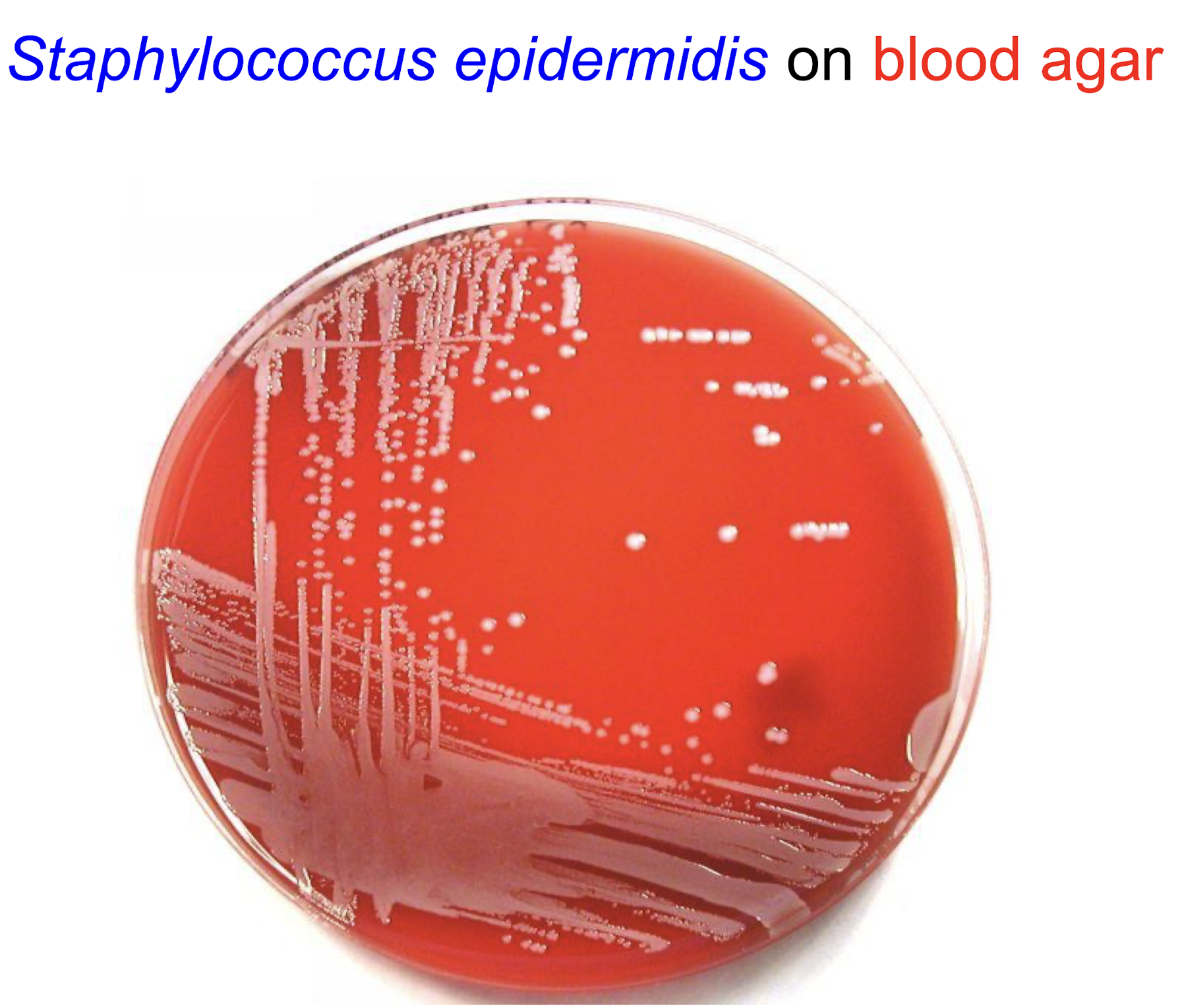 <p><strong><u>Description</u></strong></p><p><strong>– coagulase-negative </strong>(no clumping factor)</p><p>– <mark data-color="purple" style="background-color: purple; color: inherit;">Gram stain features similar to S. aureus</mark></p><p><strong>– white colonies on blood agar </strong>(no complete haemolysis, no staphyloxanthin)</p><p><strong><u>Habitat</u></strong></p><p>– most prevalent and persistent species on human skin and mucous membrane <strong>(normal flora)</strong></p>