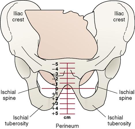 <ul><li><p>the narrowest part of the pelvis</p></li><li><p>Positive numbers mean the baby has made it through the tight squeeze and is good to go.</p><p></p></li></ul><p></p>