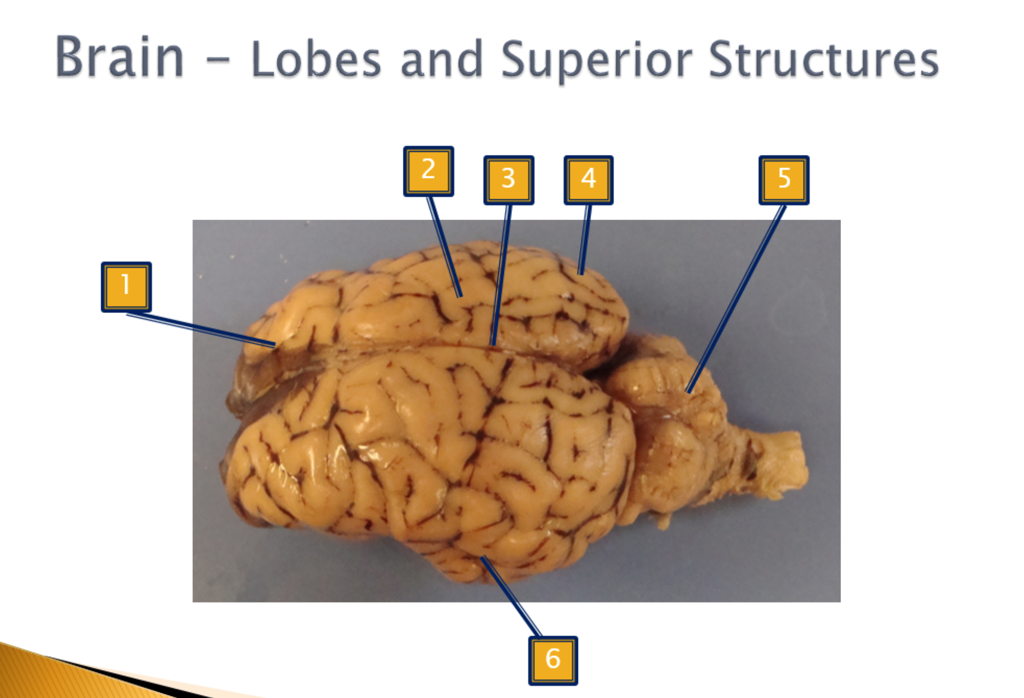 <p>Lobes and Superior Structures</p>
