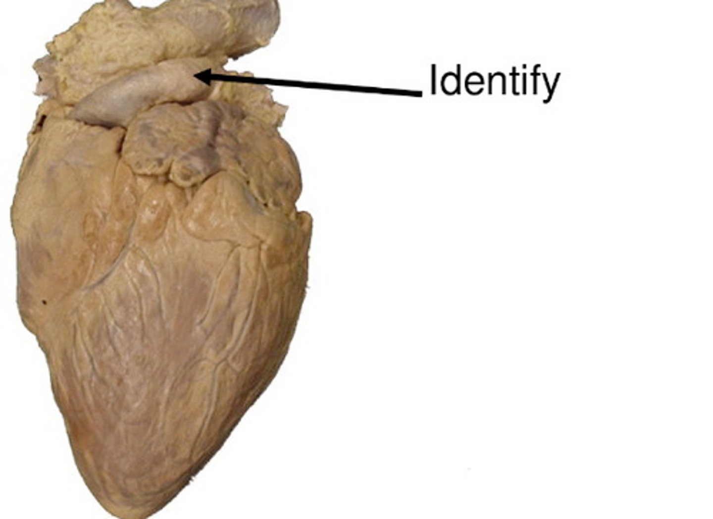 <p>seen anteriorly</p>