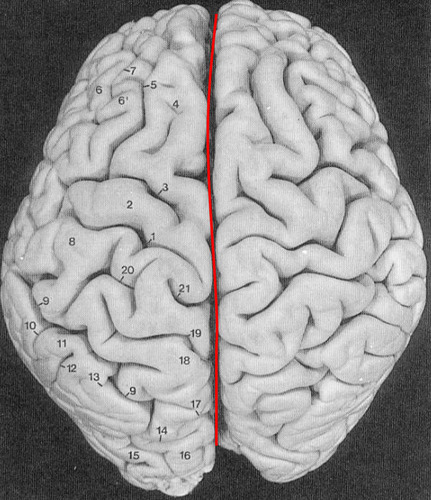<p>A long deep sulcus </p>