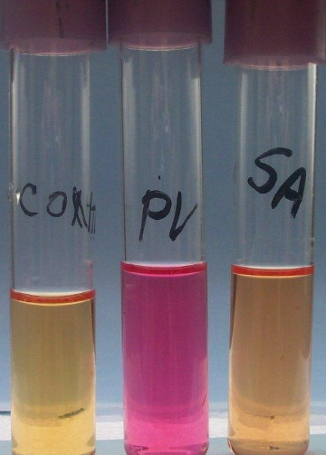 <p>What test is this?</p>