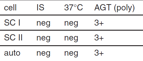 <p>possible interpretation of antibody screen </p>