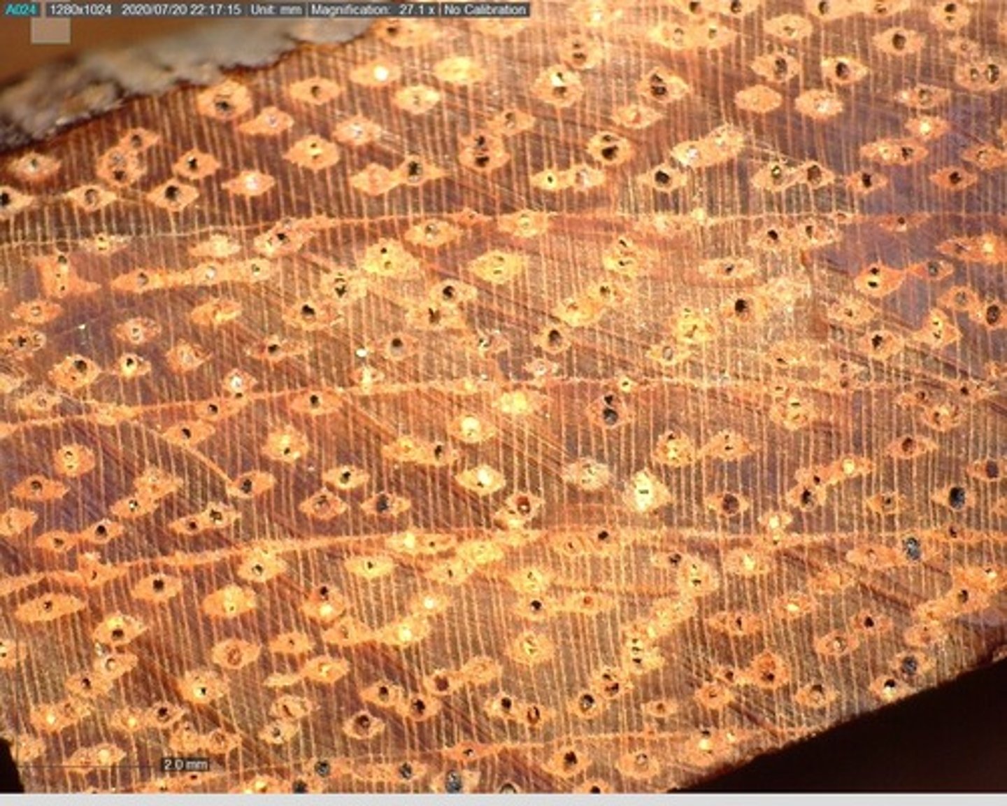 <p>Presence of reddish deposits and rounded aliform parenchyma ; gaps are visible due to associated boundary parenchyma .</p>