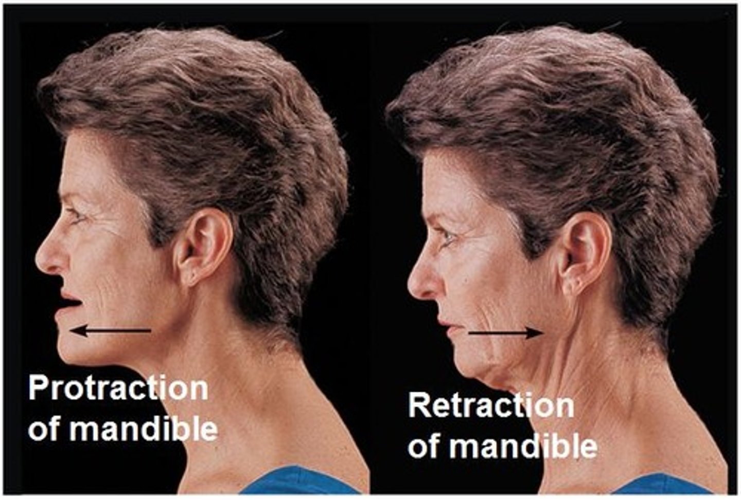 <p>Anterior / posterior movement along transverse plane</p><p>Ex. Mandible (stick chin out / pull chin back)</p>