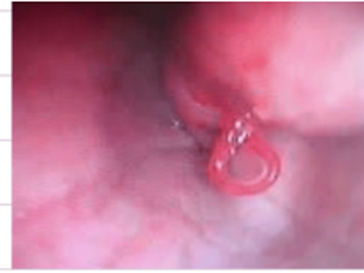 <p>what is the problem we see here?</p>