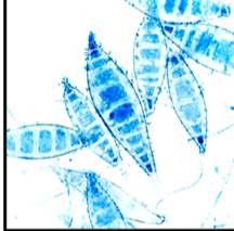 <p>This is an image from a 4-day old culture form a &quot;ringworm&quot; cutaneous infection. With this lactophenol cotton blue stain, what is the identification of this organism?</p>