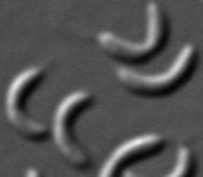 <p>Creates a shadow of sides, looks 3D (like an illusion)</p>