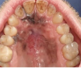 <p>what is the most likely diagnosis </p>