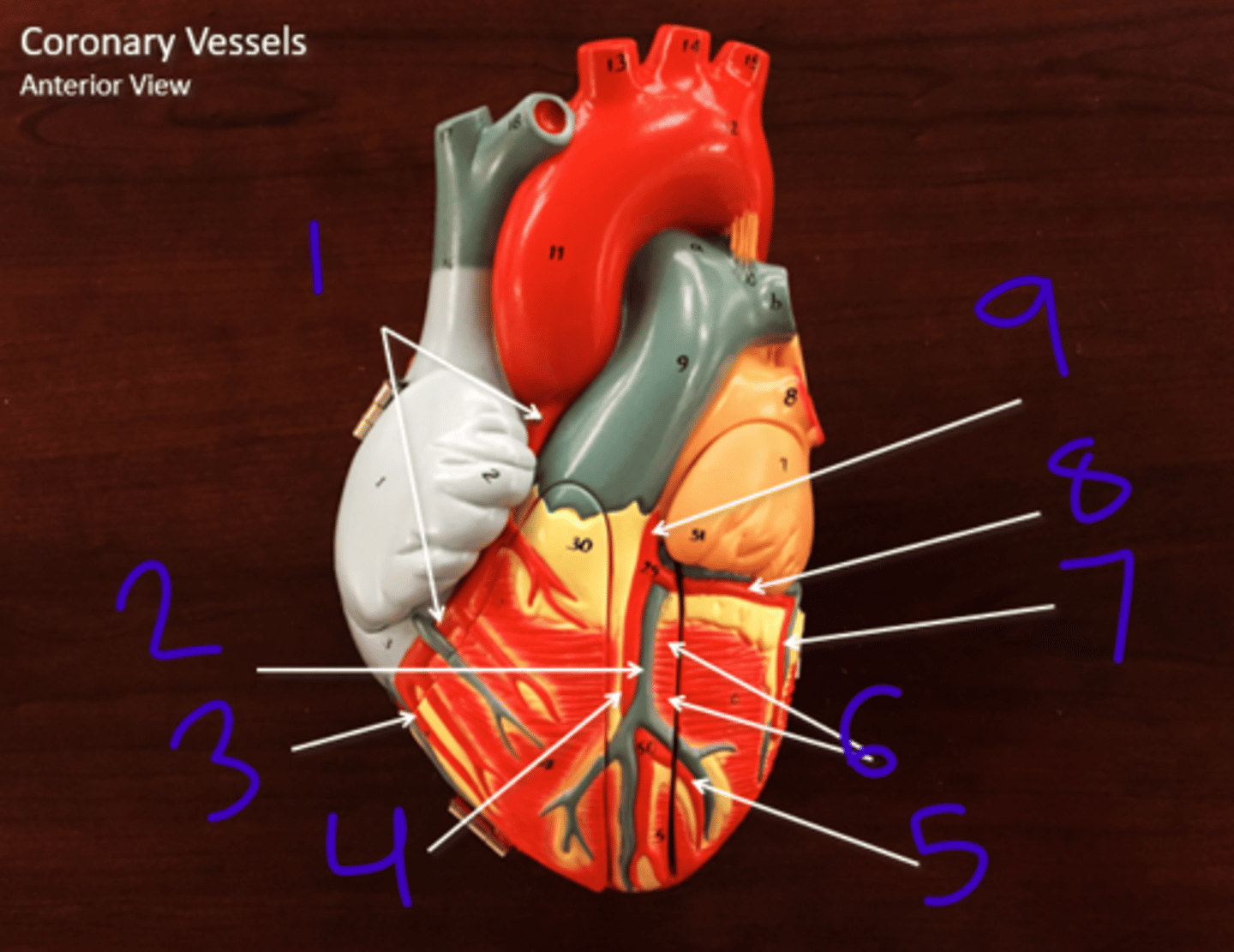 <p>Coronary vessels (anterior view) - #6</p>