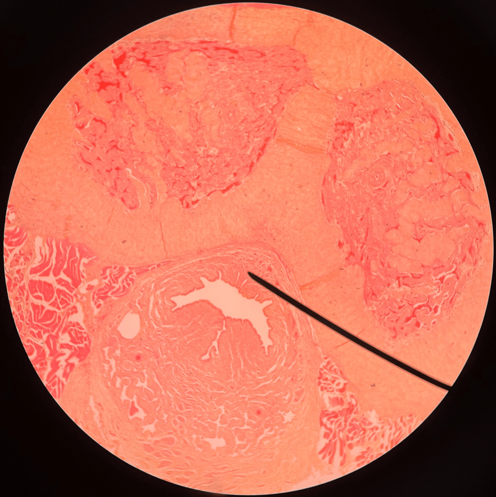 • Slide histology of a c.s. of the penis.

• A cylinder of erectile tissue found on the anterior side of the penis.

• Encircles the spongy urethra.