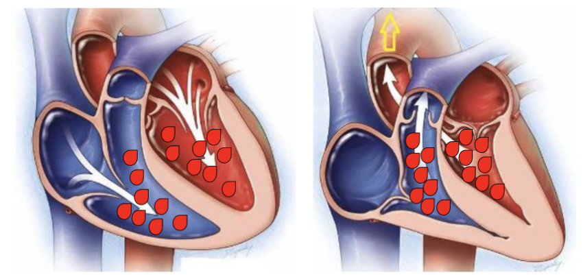 <p><span>Which heart has the highest hydrostatic pressure in the ventricles?</span></p>