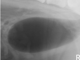 <ul><li><p>ectopic ureter</p></li><li><p>localize bladder we not seen on rads</p></li><li><p>non-opaque bladder calculi</p></li></ul><p></p>