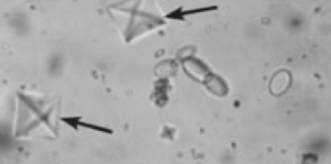 <p>Dihydrate: Octahedral</p><p>Monohydrate: dumbbell-shaped due to ethylene glycol</p>