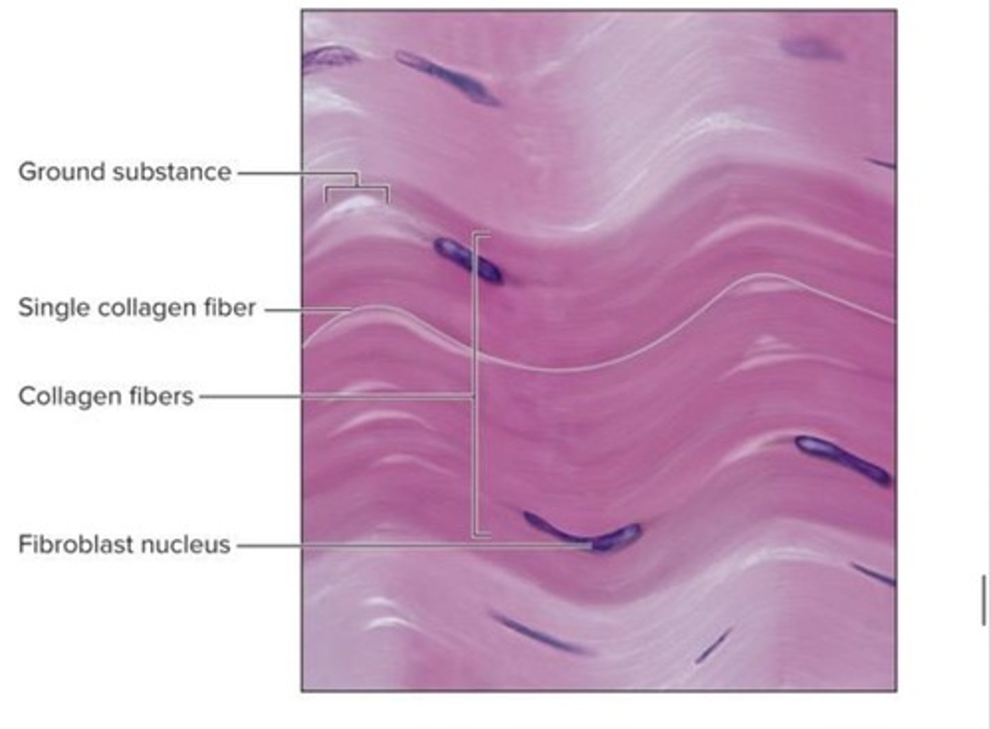 <p>What dense connective tissue is this?</p>