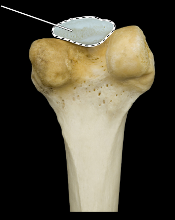 <p>Articulated right femur and patella, inferior posterior view</p>