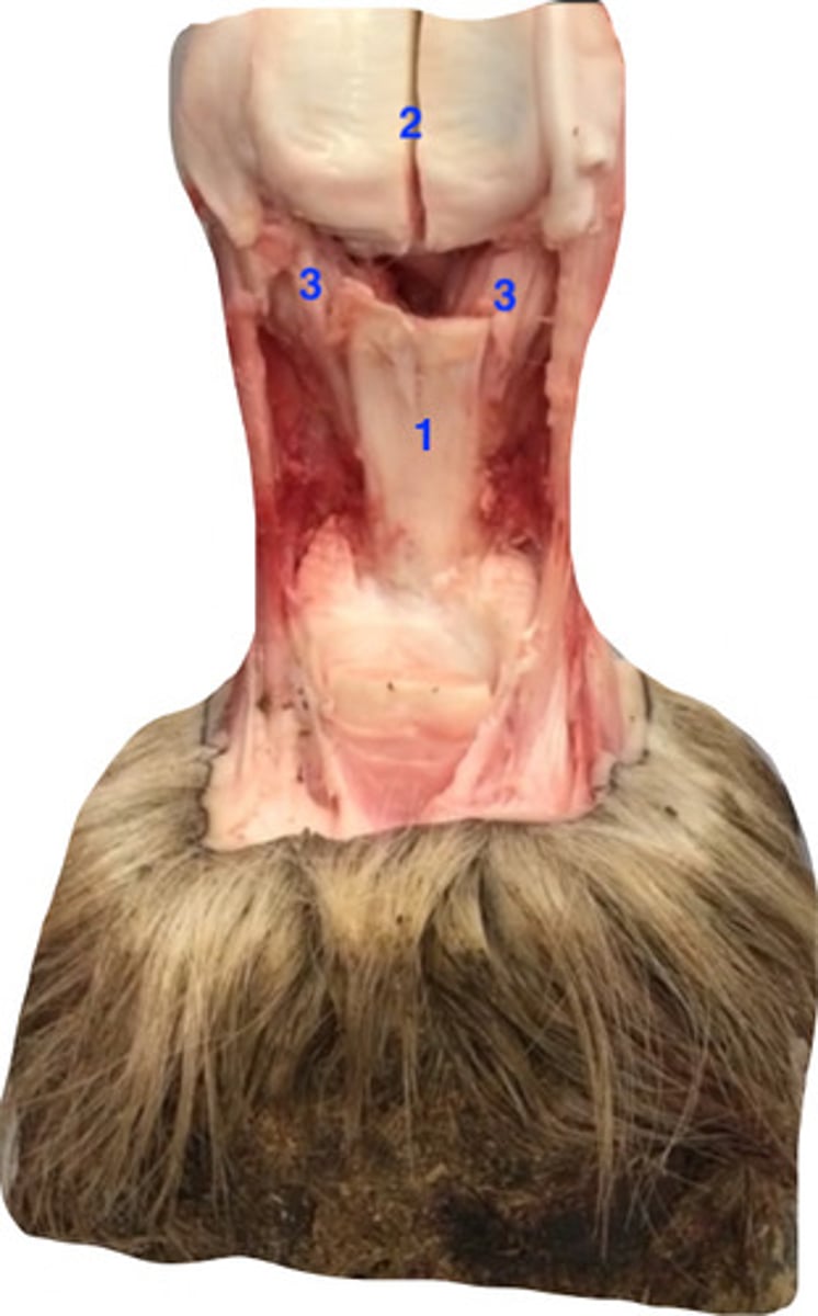 <p>sesamoidean ligaments- what is at 3?</p>