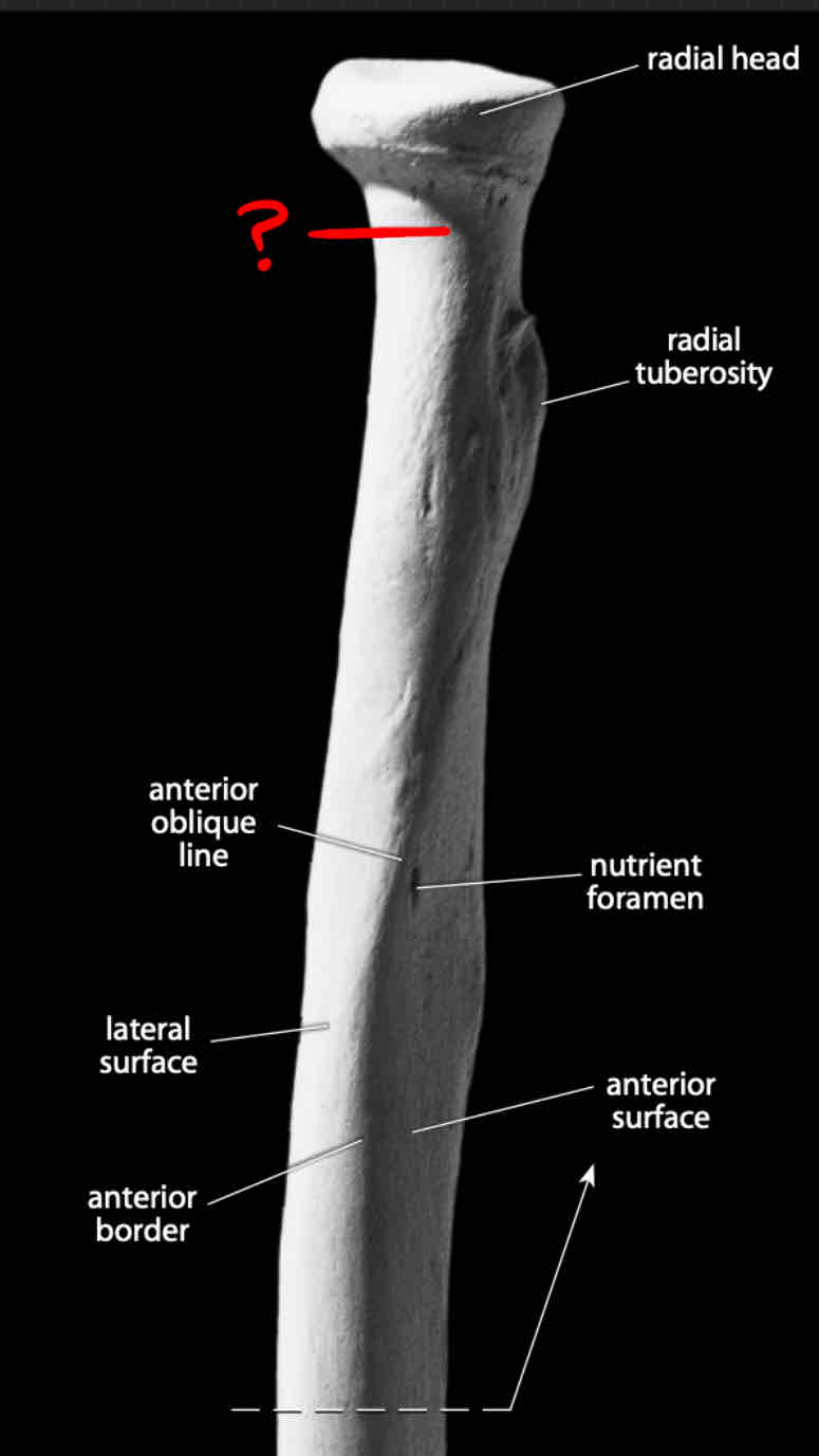 term image
