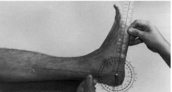 <p>Position: Supine, hip and knee extended</p><p>Examiner: Dorsiflex the ankle while maintaining the extended knee</p><ul><li><p>Axis: Lateral to the lateral malleolus </p></li><li><p>Stationary arm: Head of fibula</p></li><li><p>Movable arm: Parallel to fifth metatarsal </p></li></ul>