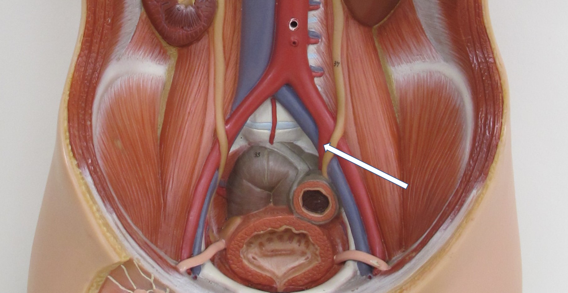 <p>arterie</p>