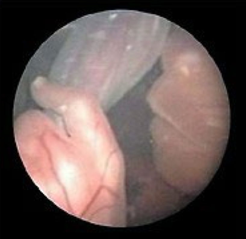 term image