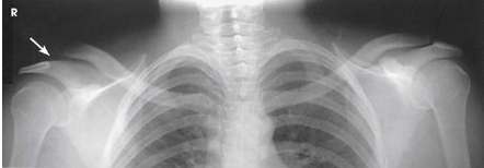 <p>What type of projection, position and anatomy is this?</p>