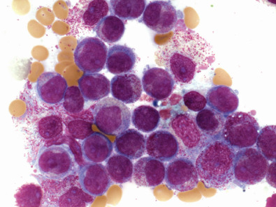 <ul><li><p>size: 14-20 um</p></li><li><p>N:C ratio is 6:1, nucleus is round/oval, and may be indented</p></li><li><p>light red-purple in color, cytoplasm may be a little blue, NO granules</p></li><li><p>CD45, CD38, CD34, CD33, CD13</p></li></ul><p></p>