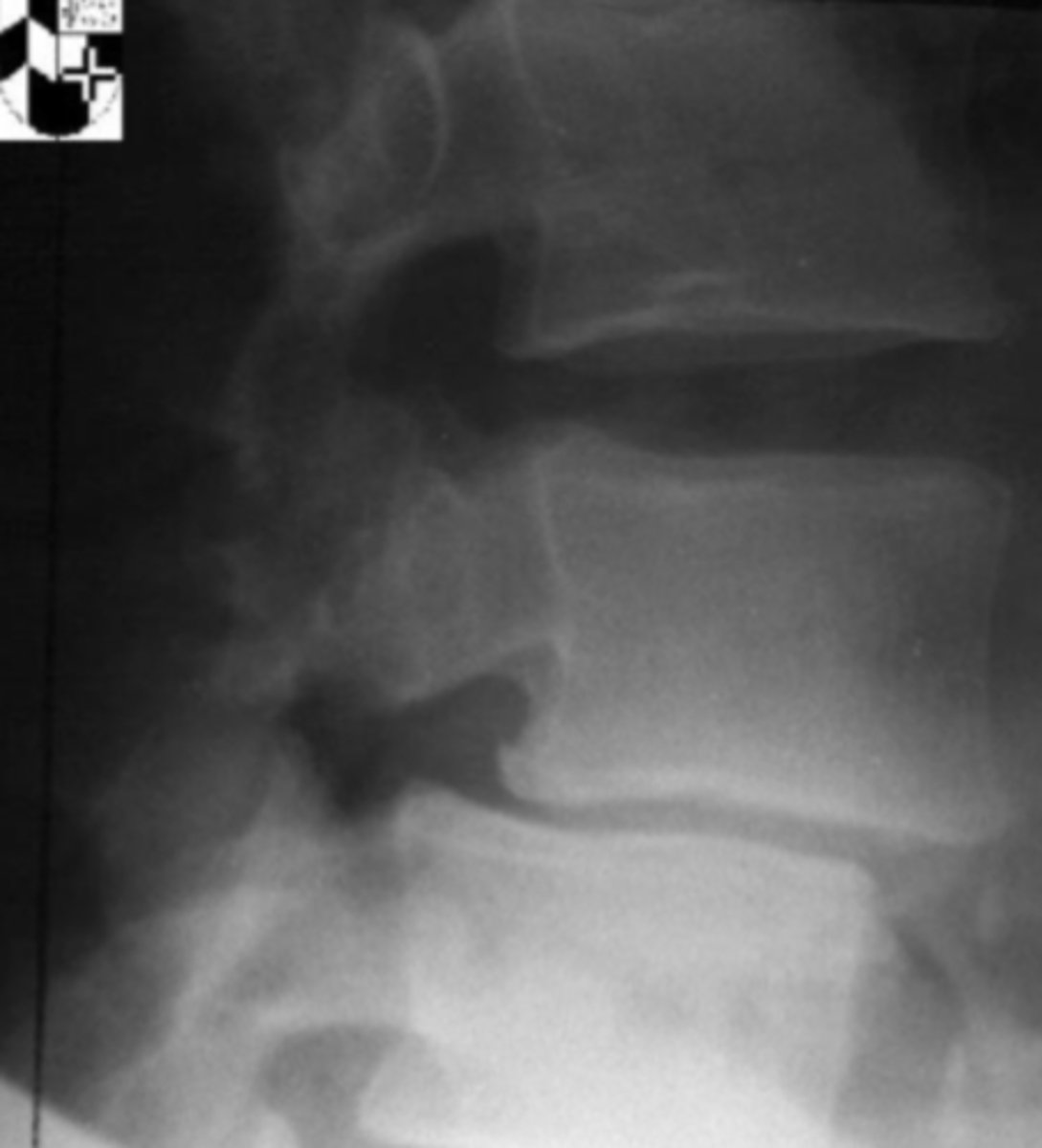 <p>What is the issue?</p>