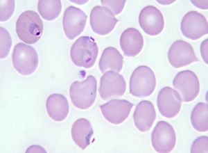 Late trophozoite Plasmodium falciparum 