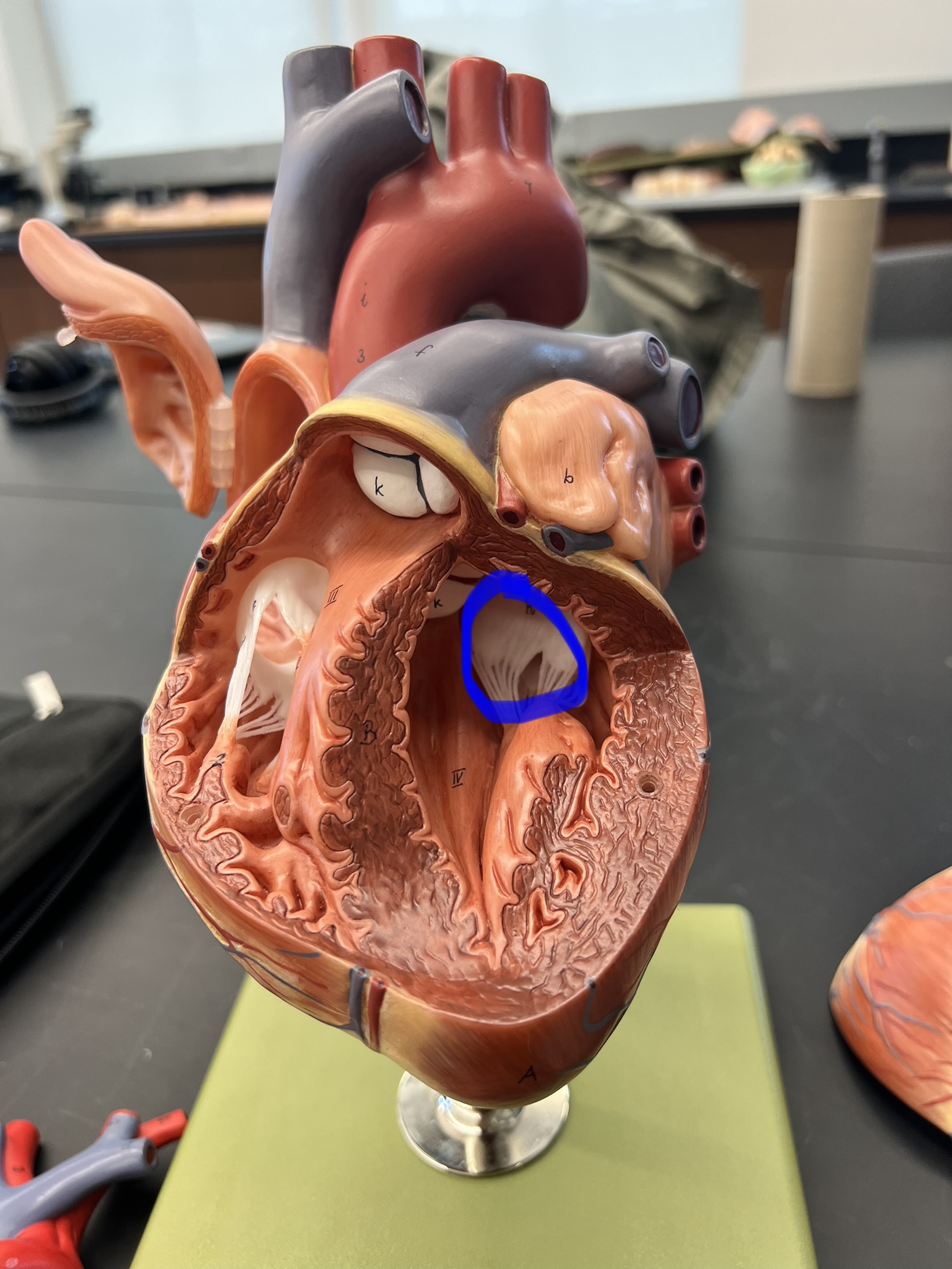 Name the heart structure (Note: Ignore strands, not a part of structure).