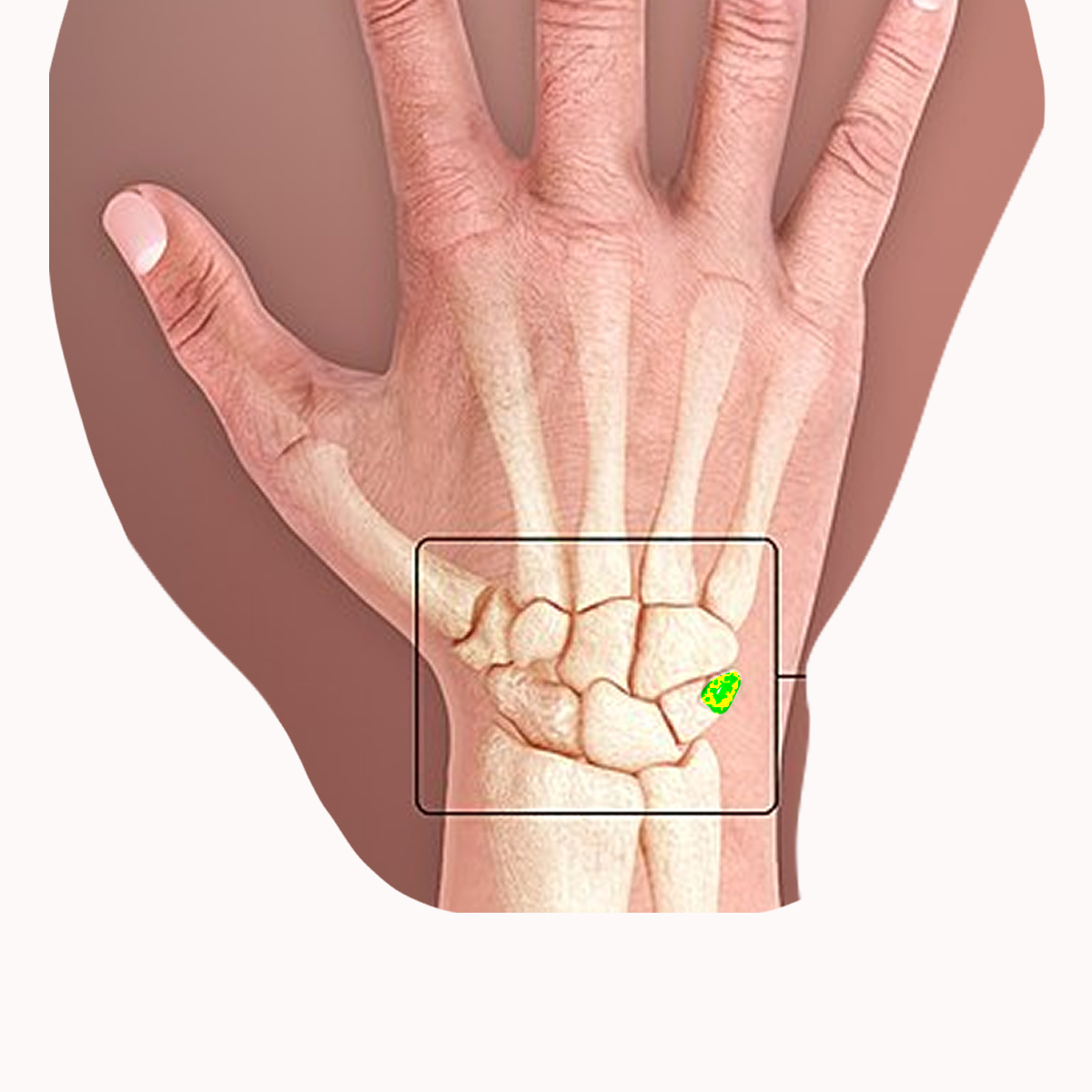 <p>Name the highlighted carpal</p>