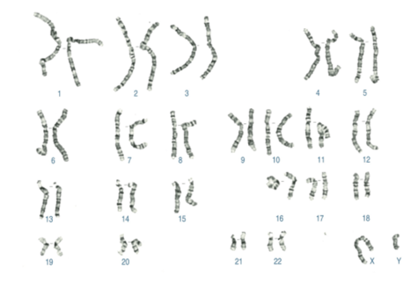 <p>Name:</p><p>- Correctly written karyotype</p><p>- Common name</p><p>- Scientific name</p><p>- One distinguishing clinical feature</p><p>- Definition of this feature if not obvious</p>