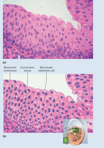 <p>Somewhat resembles stratified squamous epithelium, but surface cells are rounded, not flattened, and often bulge above surface, typically five or six cells thick when relaxed, two or three cells thick when stretched; cells may be flatter and thinner when epithelium is stretched (as in a distended bladder); some cells have two nuclei</p>