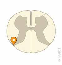 <p>sulcus </p>