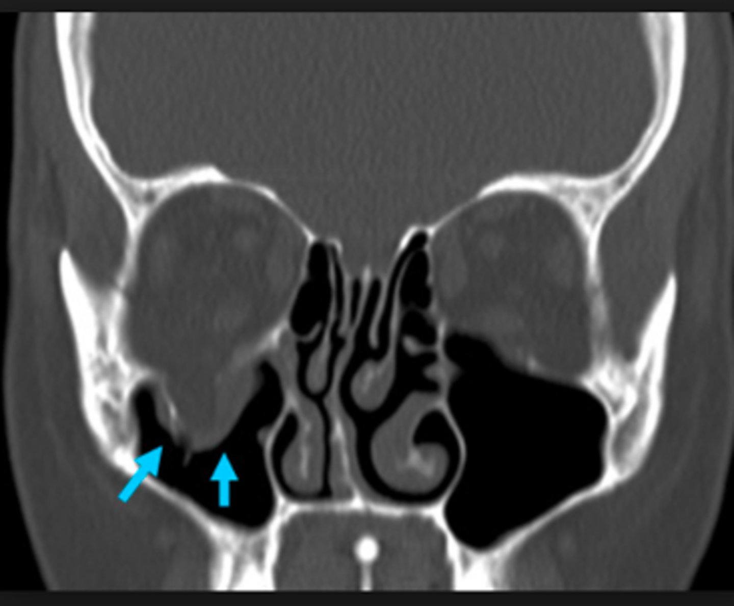 <p>what is the diangosis?</p>