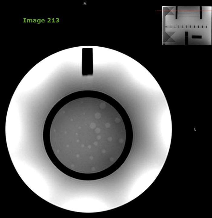 <p><strong>In acquiring ACR QA data, Image 213 is used in evaluating what quality measure?</strong></p>