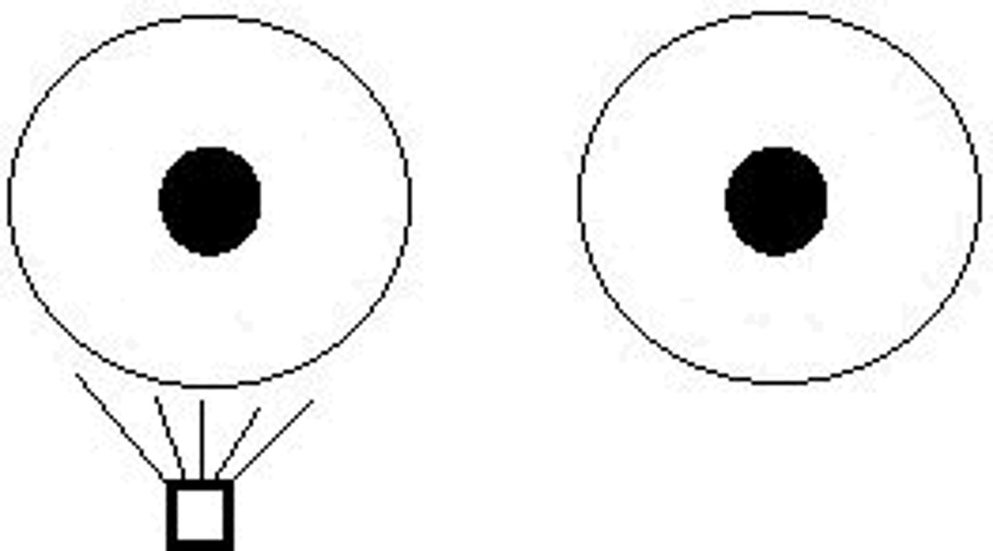 <p>Swinging flashlight test</p>