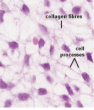 <p>What connective tissue cell is shown in the following image? </p>