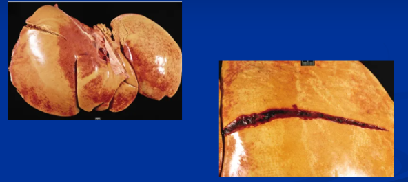 <p><span style="background-color: transparent;"> Hyperlipemia & Hepatic Lipidosis</span></p>