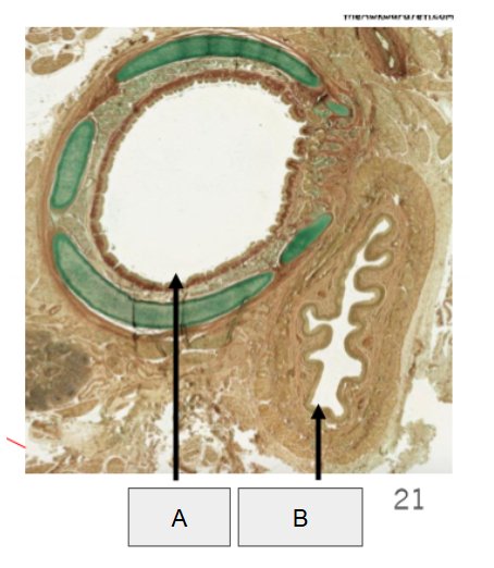 <p>A</p>