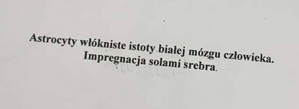 <p>tworzą barerę krew móżg oraz odżywają neurony</p>