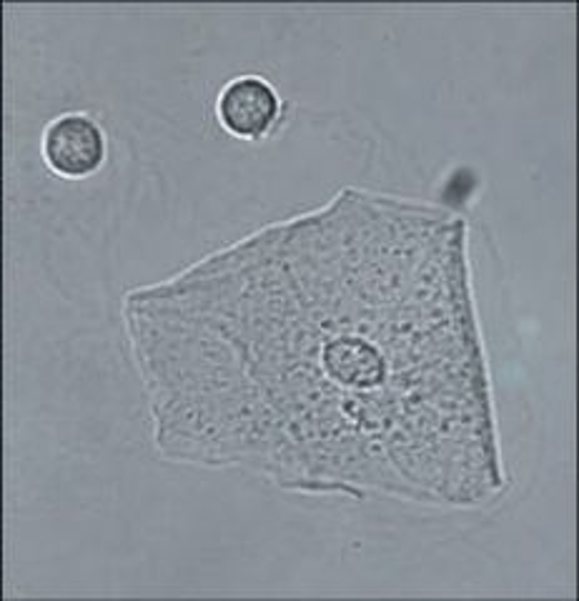 <p>Squamous Epithelial Cells</p>