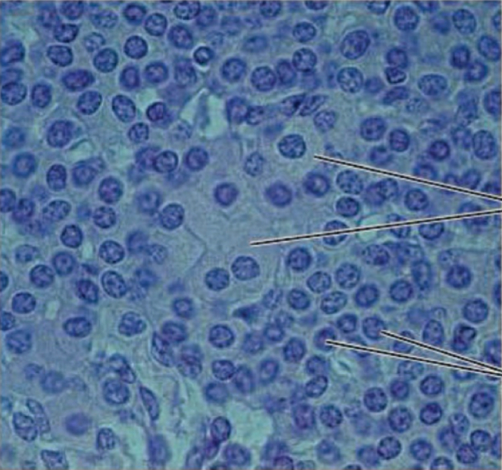 <p>What gland is this?</p>