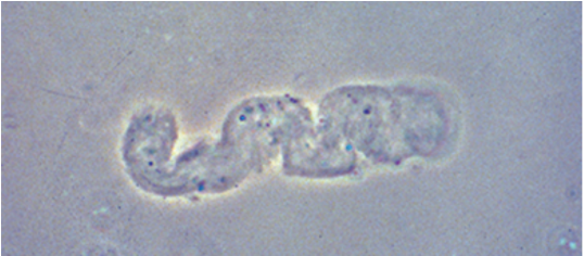 <p>-Faint, colorless</p><p>-Concentration of mucoproteins secreted from renal tubules</p><p>-Non-specific; can be normal</p>