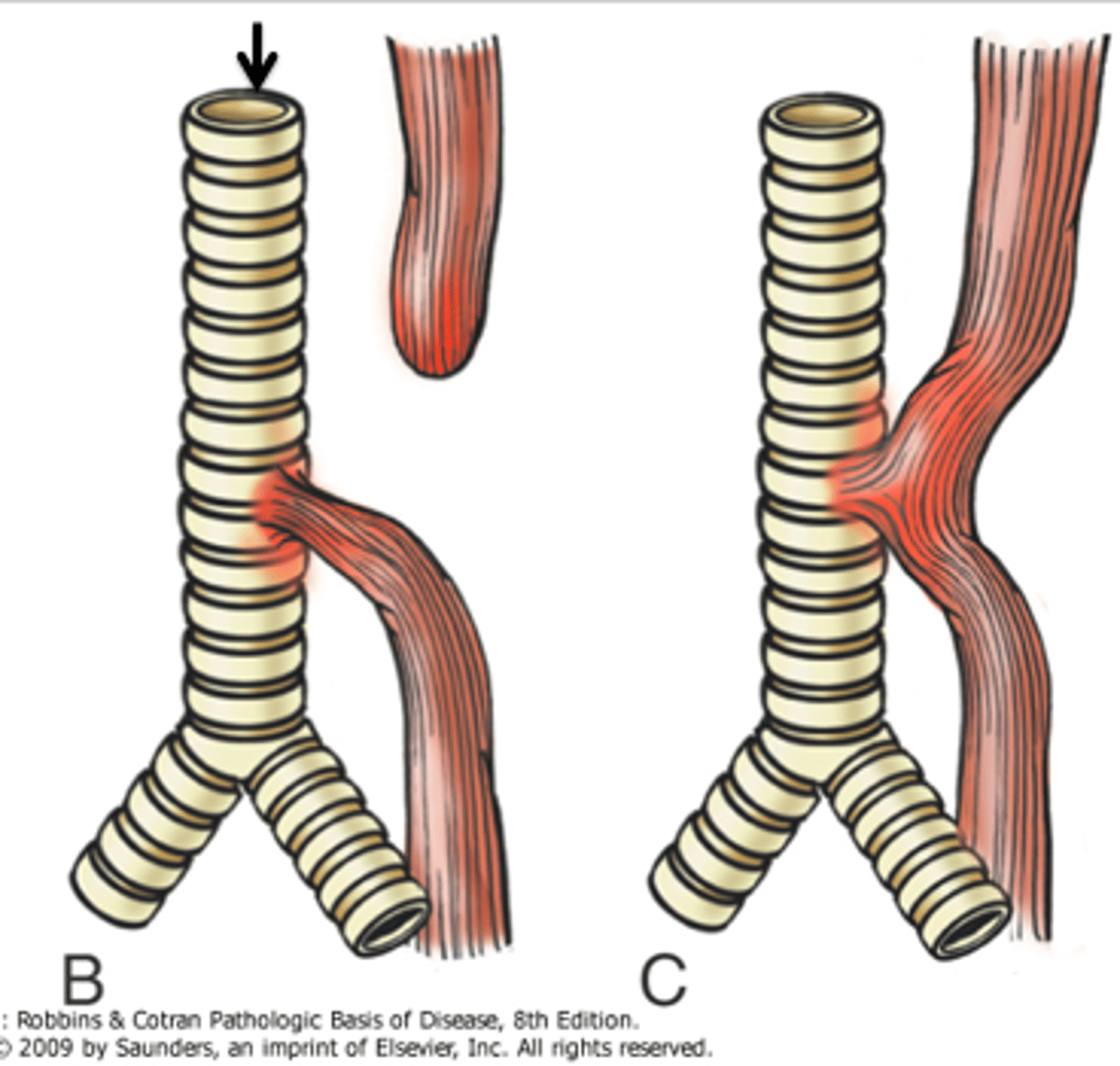 <p>Distal</p>