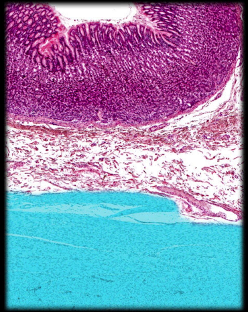 <p>very thick in the stomach. 3 layers</p>