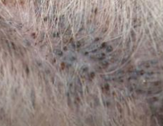 <p><span>Schnauzer Comedo Syndrome</span></p>