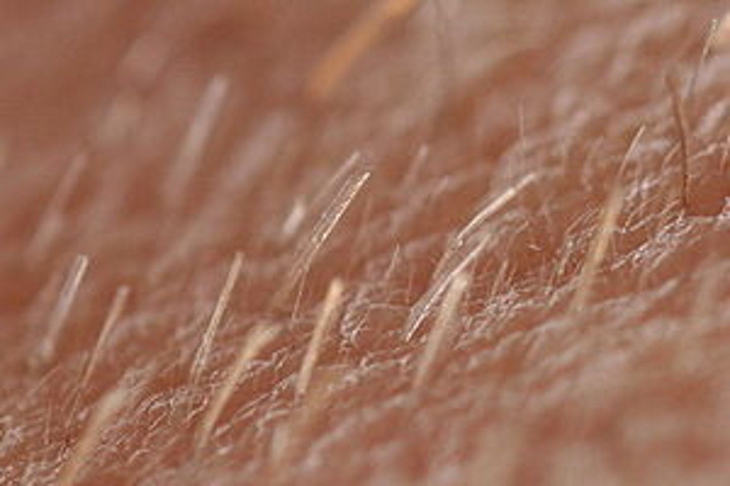 <p>(lanugo hair) short, fine, unpigmented downy hair that appears on the body, with the exception of the palms of the hands and the soles of the feet.</p>